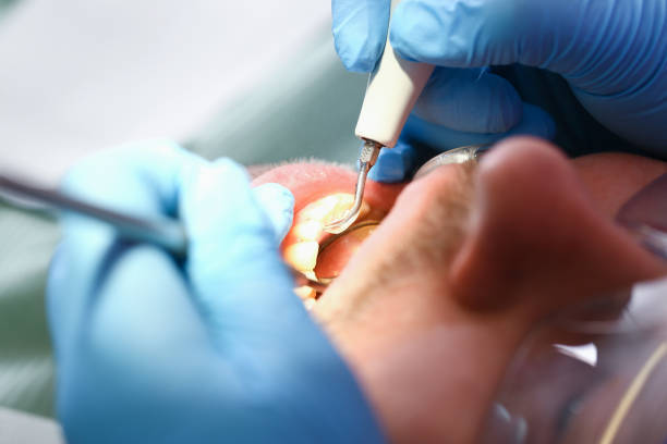 Best Urgent Dental Care for Toothaches in Stuart, VA